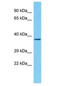 PHYHD1 Antibody - PHYHD1 antibody Western Blot of HCT15. Antibody dilution: 1 ug/ml.  This image was taken for the unconjugated form of this product. Other forms have not been tested.