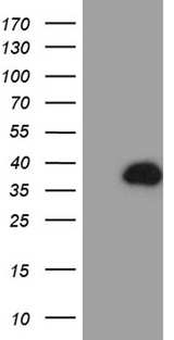 PHYHD1 Antibody - HEK293T cells were transfected with the pCMV6-ENTRY control. (Left lane) or pCMV6-ENTRY PHYHD1. (Right lane) cDNA for 48 hrs and lysed. Equivalent amounts of cell lysates. (5 ug per lane) were separated by SDS-PAGE and immunoblotted with anti-PHYHD1. (1:2000)