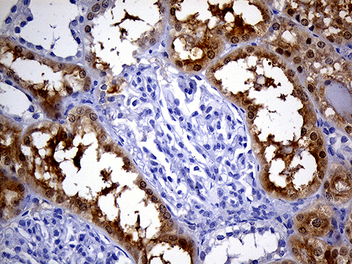 PHYHD1 Antibody - Immunohistochemical staining of paraffin-embedded Human Kidney tissue within the normal limits using anti-PHYHD1 mouse monoclonal antibody. (Heat-induced epitope retrieval by 1mM EDTA in 10mM Tris buffer. (pH8.5) at 120°C for 3 min. (1:500)