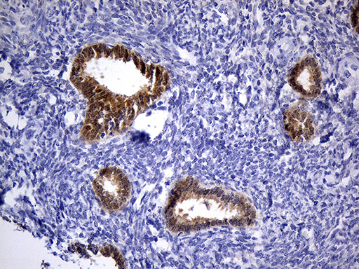 PHYHD1 Antibody - Immunohistochemical staining of paraffin-embedded Human endometrium tissue within the normal limits using anti-PHYHD1 mouse monoclonal antibody. (Heat-induced epitope retrieval by 1mM EDTA in 10mM Tris buffer. (pH8.5) at 120°C for 3 min. (1:500)