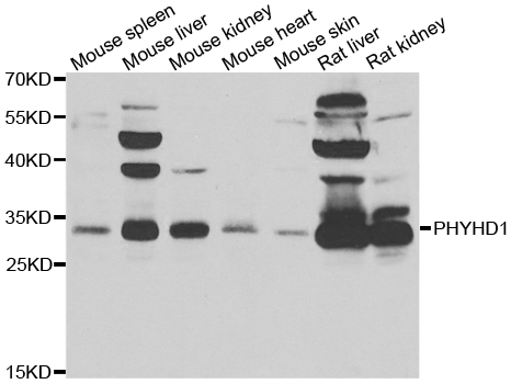 PHYHD1 Antibody - Western blot analysis of extracts of various cell lines.