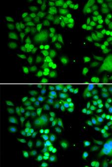 PHYHD1 Antibody - Immunofluorescence analysis of MCF7 cells.
