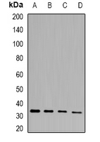 PHYHD1 Antibody - Western blot analysis of PHYHD1 expression in mouse heart (A); mouse skin (B); rat liver (C); rat kidney (D) whole cell lysates.