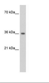 PHYHIP Antibody - Transfected 293T Cell Lysate.  This image was taken for the unconjugated form of this product. Other forms have not been tested.