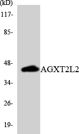 PHYKPL / AGXT2L2 Antibody - Western blot analysis of the lysates from HUVECcells using AGXT2L2 antibody.