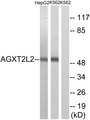 PHYKPL / AGXT2L2 Antibody - Western blot analysis of lysates from K562 and HepG2 cells, using AGXT2L2 Antibody. The lane on the right is blocked with the synthesized peptide.