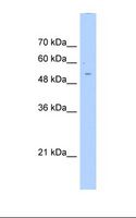 PHYKPL / AGXT2L2 Antibody - HepG2 cell lysate. Antibody concentration: 0.25 ug/ml. Gel concentration: 12%.  This image was taken for the unconjugated form of this product. Other forms have not been tested.