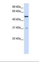 PHYKPL / AGXT2L2 Antibody - Fetal liver lysate. Antibody concentration: 1.0 ug/ml. Gel concentration: 12%.  This image was taken for the unconjugated form of this product. Other forms have not been tested.