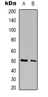 PHYKPL / AGXT2L2 Antibody - Western blot analysis of AGXT2L2 expression in HepG2 (A); A431 (B) whole cell lysates.