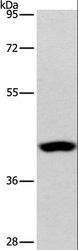 PHYKPL / AGXT2L2 Antibody - Western blot analysis of Human lymphoma tissue, using AGXT2L2 Polyclonal Antibody at dilution of 1:550.