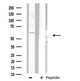 PHYKPL / AGXT2L2 Antibody - Western blot analysis of extracts of HepG2 cells using AGXT2L2 antibody.