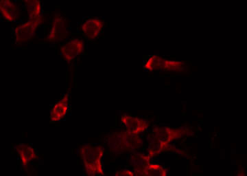 PHYKPL / AGXT2L2 Antibody - Staining HeLa cells by IF/ICC. The samples were fixed with PFA and permeabilized in 0.1% Triton X-100, then blocked in 10% serum for 45 min at 25°C. The primary antibody was diluted at 1:200 and incubated with the sample for 1 hour at 37°C. An Alexa Fluor 594 conjugated goat anti-rabbit IgG (H+L) Ab, diluted at 1/600, was used as the secondary antibody.