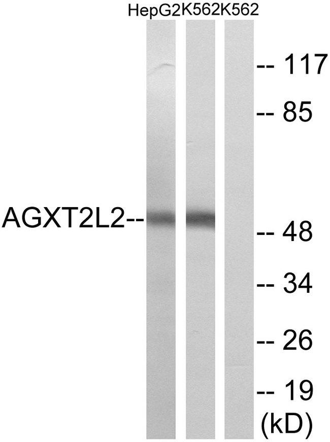 PHYKPL / AGXT2L2 Antibody - Western blot analysis of extracts from HepG2 cells and K562 cells, using AGXT2L2 antibody.