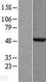 PHYKPL / AGXT2L2 Protein - Western validation with an anti-DDK antibody * L: Control HEK293 lysate R: Over-expression lysate