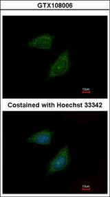 PI15 Antibody - Immunofluorescence of methanol-fixed HeLa using Protease Inhibitor 15 antibody at 1:500 dilution.