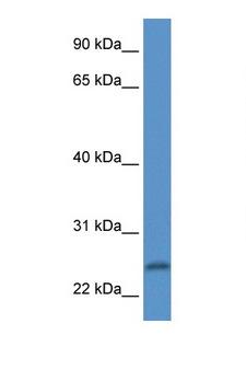PI15 Antibody - PI15 antibody Western blot of Fetal Heart lysate. Antibody concentration 1 ug/ml.  This image was taken for the unconjugated form of this product. Other forms have not been tested.