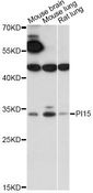 PI15 Antibody - Western blot analysis of extracts of various cell lines, using PI15 antibody at 1:1000 dilution. The secondary antibody used was an HRP Goat Anti-Rabbit IgG (H+L) at 1:10000 dilution. Lysates were loaded 25ug per lane and 3% nonfat dry milk in TBST was used for blocking. An ECL Kit was used for detection and the exposure time was 90s.