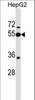 PI16 Antibody - PI16 Antibody western blot of HepG2 cell line lysates (35 ug/lane). The PI16 antibody detected the PI16 protein (arrow).