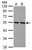PI16 Antibody - Sample (30 ug of whole cell lysate) A: A549 B: HeLa 10% SDS PAGE PI16 antibody diluted at 1:1000