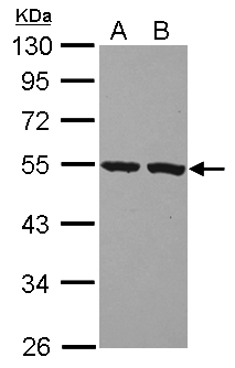 PI16 Antibody - Sample (30 ug of whole cell lysate) A: A549 B: HeLa 10% SDS PAGE PI16 antibody diluted at 1:1000