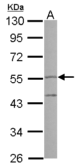 PI16 Antibody - Sample (30 ug of whole cell lysate) A: A549 10% SDS PAGE PI16 antibody diluted at 1:1000