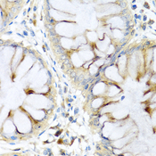 PI3 / Elafin Antibody - Immunohistochemistry of paraffin-embedded human colon tissue.