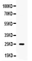 PI3 / Elafin Antibody - Western blot - Anti-Elafin/PI3 Picoband Antibody