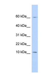 PI3 / Elafin Antibody - PI3 antibody Western blot of 721_B cell lysate. This image was taken for the unconjugated form of this product. Other forms have not been tested.