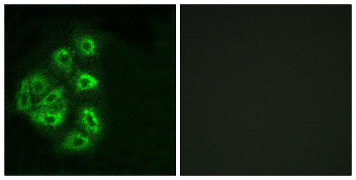 PI3K Alpha+Gamma Antibody - Immunofluorescence analysis of HeLa cells, using PI3-kinase p85-alpha/gamma Antibody. The picture on the right is blocked with the synthesized peptide.
