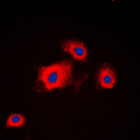 PI3K Alpha+Gamma Antibody - Immunofluorescent analysis of PI3K p85 alpha/p55 gamma staining in HeLa cells. Formalin-fixed cells were permeabilized with 0.1% Triton X-100 in TBS for 5-10 minutes and blocked with 3% BSA-PBS for 30 minutes at room temperature. Cells were probed with the primary antibody in 3% BSA-PBS and incubated overnight at 4 C in a humidified chamber. Cells were washed with PBST and incubated with a DyLight 594-conjugated secondary antibody (red) in PBS at room temperature in the dark. DAPI was used to stain the cell nuclei (blue).
