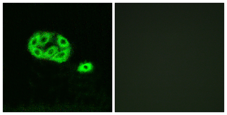 PI3K Alpha+Gamma Antibody - Immunofluorescence analysis of NIH/3T3 cells, using PI3-kinase p85-alpha/gamma (Phospho-Tyr467/199) Antibody. The picture on the right is blocked with the phospho peptide.