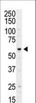 PI4K2A / PI4KII Antibody - Western blot of anti-PI4K II antibody in HL60 cell lysate. PI4K II (arrow) was detected using purified antibody. Secondary HRP-anti-rabbit was used for signal visualization with chemiluminescence.