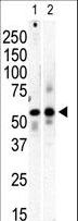 PI4K2B Antibody - Western blot of anti-PI4K II beta antibody in mouse brain (Lane A) and Saos-2 (Lane B) cell lysate. PI4K II beta (arrow) was detected using purified antibody. Secondary HRP-anti-rabbit was used for signal visualization with chemiluminescence.
