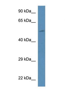 PI4K2B Antibody - PI4K2B antibody Western blot of Mouse Liver lysate. Antibody concentration 1 ug/ml. This image was taken for the unconjugated form of this product. Other forms have not been tested.