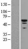 PI4K2B Protein - Western validation with an anti-DDK antibody * L: Control HEK293 lysate R: Over-expression lysate