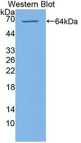 PI4KA Antibody - Western blot of PI4KA antibody.