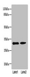 PI4KA Antibody - Western blot All Lanes: PI4KAP1 antibody at 10ug/ml Lane 1: Mouse gonadal tissue Lane 2: 293T whole cell lysate Goat polyclonal to Rabbit IgG at 1/10000 dilution Predicted band size: 29 kDa Observed band size: 29 kDa