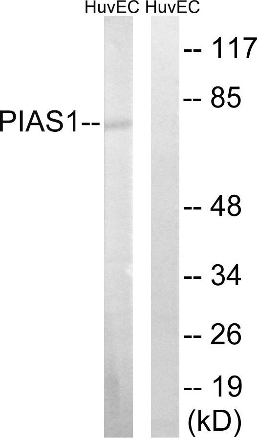 PIAS1 Antibody - Western blot analysis of lysates from HUVEC cells, using PIAS1 Antibody. The lane on the right is blocked with the synthesized peptide.