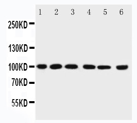 PIAS1 Antibody - WB of PIAS1 antibody. All lanes: Anti-PIAS1 at 0.5ug/ml. Lane 1: Rat Testis Tissue Lysate at 40ug. Lane 2: Mouse Testis Tissue Lysate at 40ug. Lane 3: HELA Whole Cell Lysate at 40ug. Lane 4: JURKAT Whole Cell Lysate at 40ug. Lane 5: MCF-7 Whole Cell Lysate at 40ug. Lane 6: SKOV Whole Cell Lysate at 40ug. Predicted bind size: 72KD. Observed bind size: 100KD.