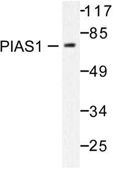 PIAS1 Antibody - Western blot of PIAS1 (G24) pAb in extracts from Jurkat cells.