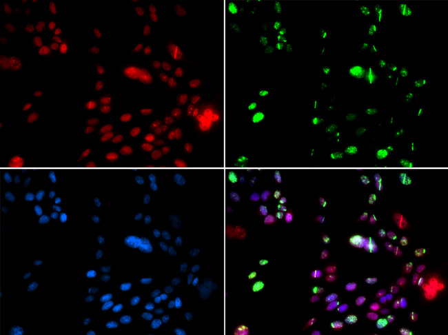 PIAS1 Antibody - Immunofluorescence analysis of GFP-RNF168 transgenic U2OS cells.