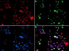 PIAS1 Antibody - Immunofluorescence analysis of GFP-RNF168 transgenic U2OS cells.