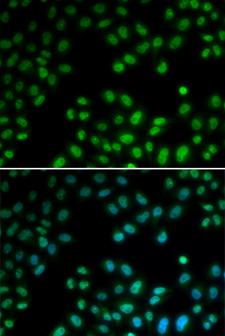 PIAS1 Antibody - Immunofluorescence analysis of U2OS cells.