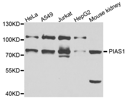 PIAS1 Antibody - Western blot analysis of extracts of various cell lines, using PIAS1 antibody at 1:1000 dilution. The secondary antibody used was an HRP Goat Anti-Rabbit IgG (H+L) at 1:10000 dilution. Lysates were loaded 25ug per lane and 3% nonfat dry milk in TBST was used for blocking. An ECL Kit was used for detection and the exposure time was 90s.