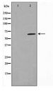PIAS1 Antibody - Western blot of MDA-MB-435 cell lysate using PIAS1 Antibody