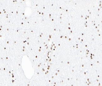 PIAS1 Antibody - 1:100 staining human brain tissue by IHC-P. The tissue was formaldehyde fixed and a heat mediated antigen retrieval step in citrate buffer was performed. The tissue was then blocked and incubated with the antibody for 1.5 hours at 22°C. An HRP conjugated goat anti-rabbit antibody was used as the secondary.