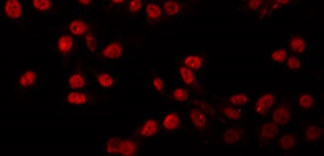 PIAS1 Antibody - Staining MDA-MB-435 cells by IF/ICC. The samples were fixed with PFA and permeabilized in 0.1% Triton X-100, then blocked in 10% serum for 45 min at 25°C. The primary antibody was diluted at 1:200 and incubated with the sample for 1 hour at 37°C. An Alexa Fluor 594 conjugated goat anti-rabbit IgG (H+L) Ab, diluted at 1/600, was used as the secondary antibody.