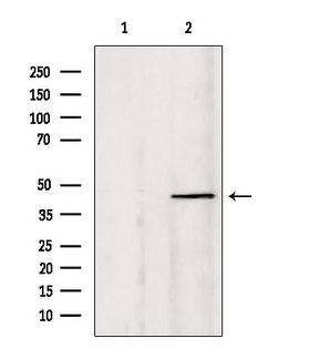 PIAS1 Antibody - Western blot analysis of extracts of HepG2 cells using PIAS1 antibody. Lane 1 was treated with the blocking peptide.