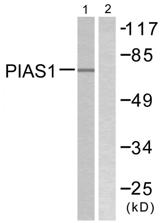 PIAS1 Antibody - Western blot analysis of extracts from MDA-MB-435 cells, using PIAS1 antibody.