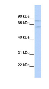 PIAS1 Antibody - PIAS1 antibody Western blot of Placenta lysate. This image was taken for the unconjugated form of this product. Other forms have not been tested.